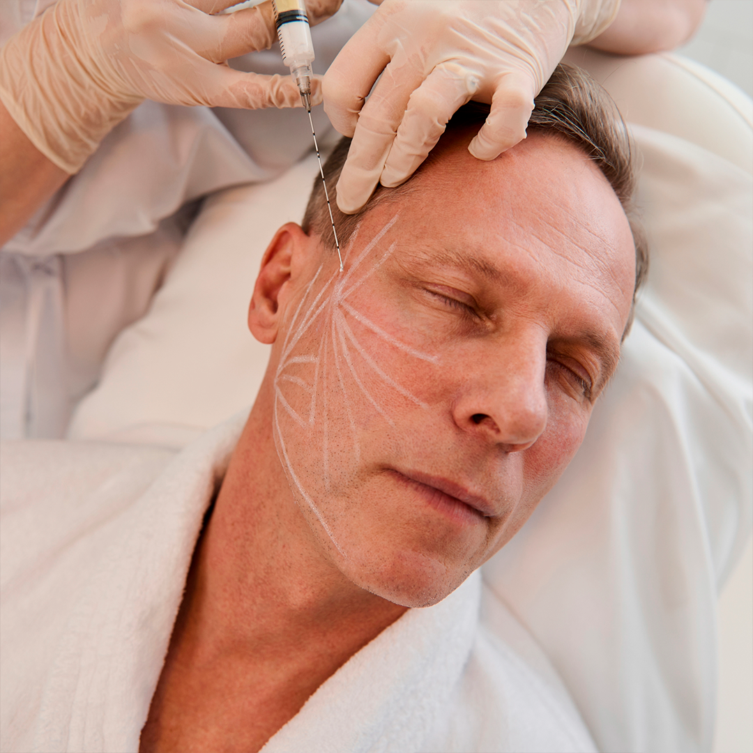 Aplicação de Toxina Botulínica (Botox)