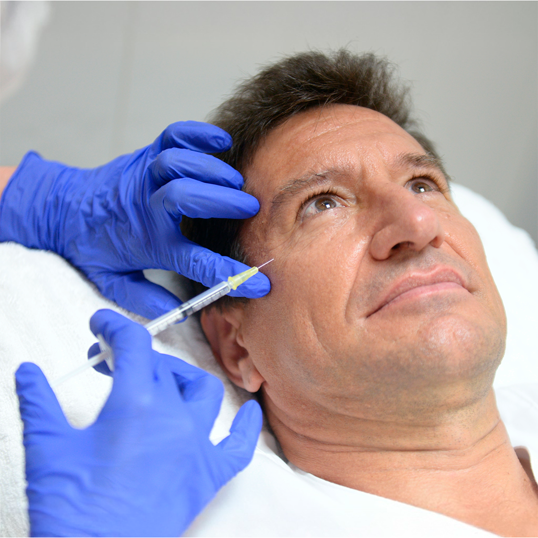 Bioestimuladores de Colágeno