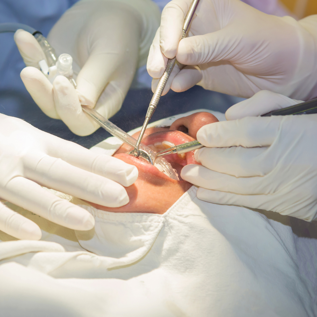 Extrações Dentárias
